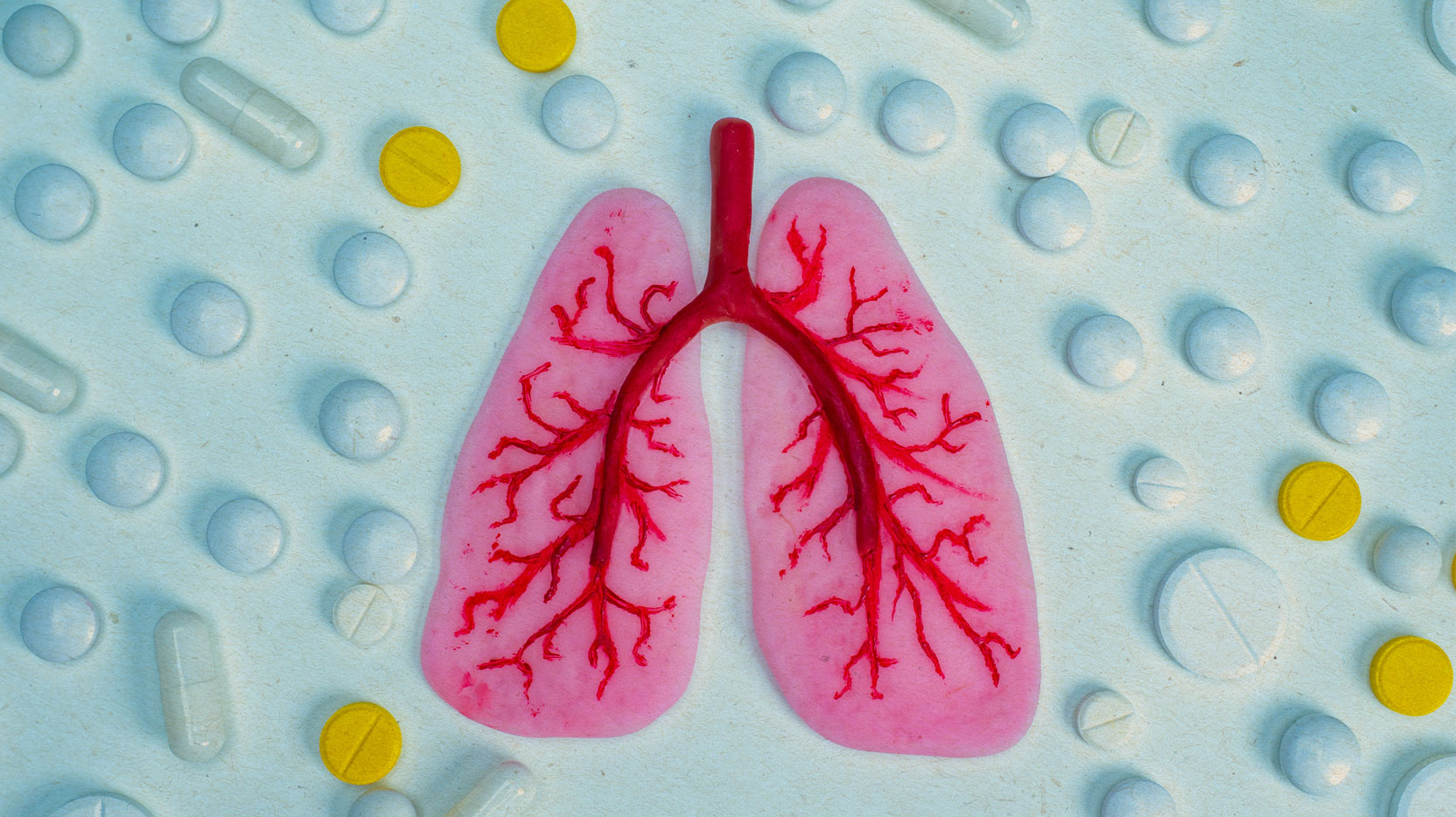 La tuberculose progresse en Belgique